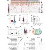 生信分析GEO KEGG差异基因通路富集网络药理PPI WGCNA TCGA GSEA