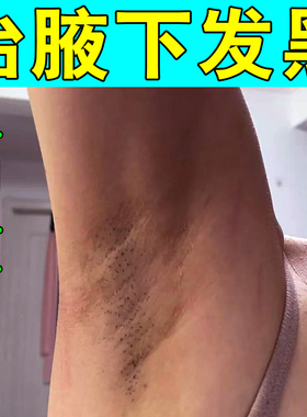 腋下发黑严重腋窝黑色素沉淀男女腋下黑点黑斑脖子手肘黑修护乳膏