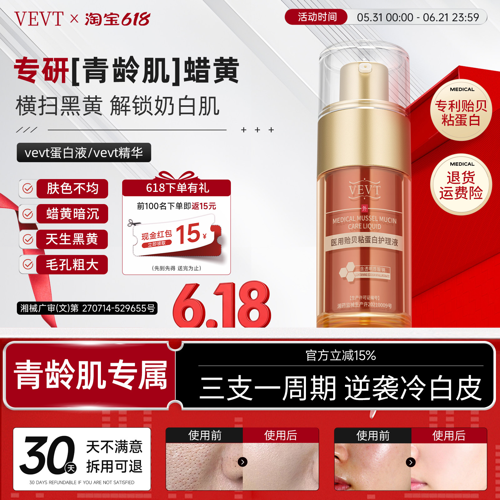 【艺考生同款】vevt蛋白液vevt精华vev蛋白护理液vvet减黄收毛孔