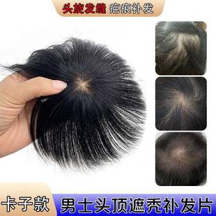 假发片男士补发块发丝头旋男士遮盖伤疤一片式脱发补发片无痕透气