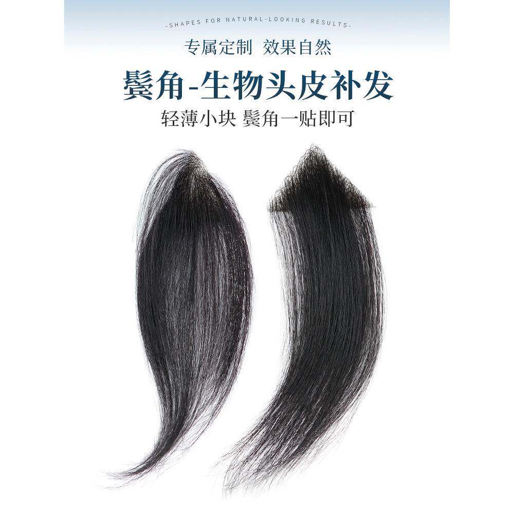 鬓角补发男女通用全真人发丝男士假刘海片前额头m型发际线假发贴
