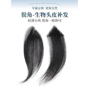 鬓角补发男女通用全真人发丝男士假刘海片前额头m型发际线假发贴