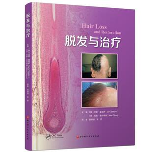 JerryShapi 杰里·夏皮罗 脱发与治疗 美