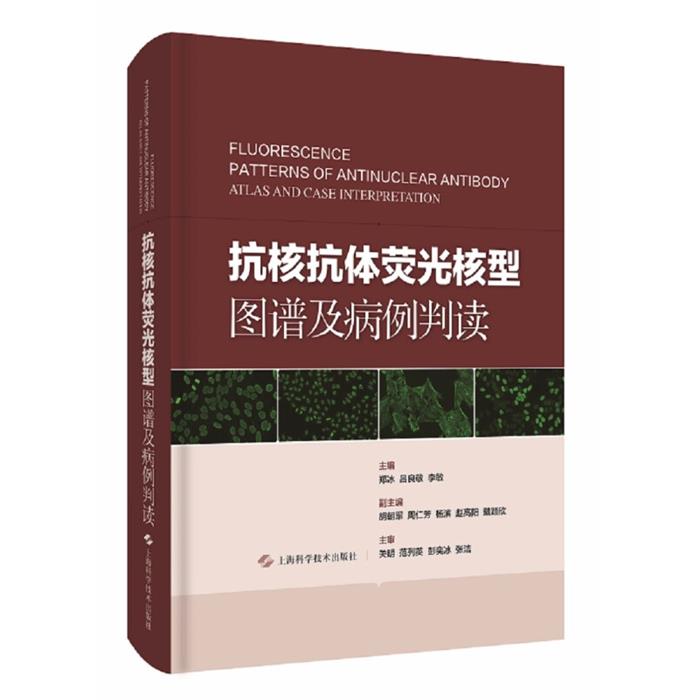 抗核抗体荧光核型图谱及病例判读郑冰，吕良敬，李敏