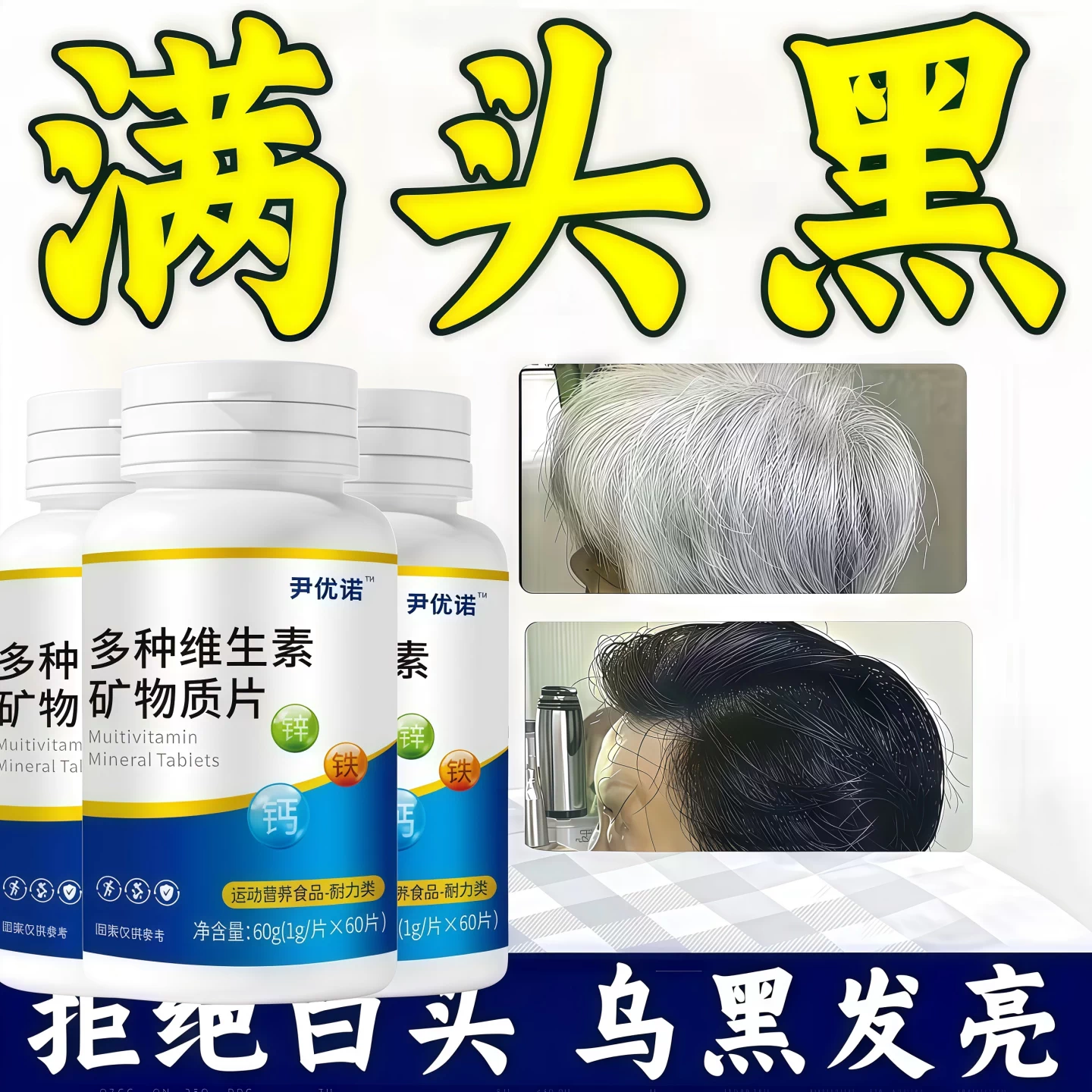 尹优诺维生素b白发脱发养发护发乌发素黑男女用中老年发官方Yy2