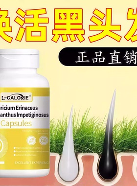 沃普维生素B希乌发素维生素d3白发黑发掉发护发秀发