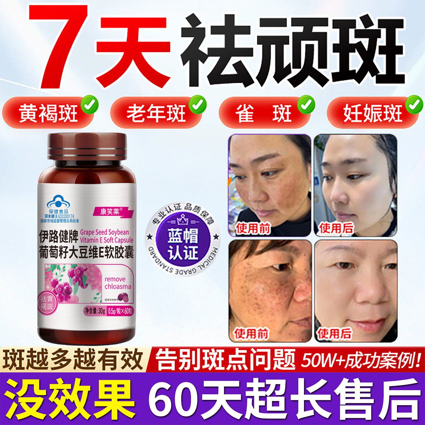 祛斑内调黄褐斑雀斑维生素E葡萄籽提取物胶囊美白去斑淡斑
