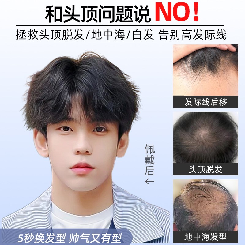 假发男微分碎盖纹理烫全手织韩系日常男生自然真发男士头顶补发片