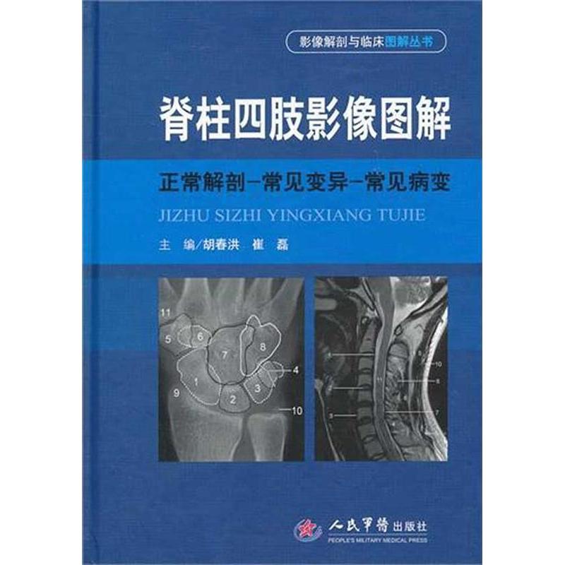 【正版书籍】脊柱四肢影像图解正常解剖常见变异常见病变胡春江崔磊人民军医出版社