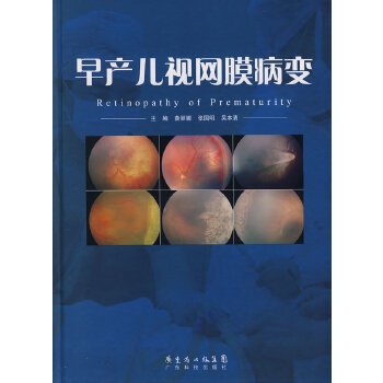 【正版书籍】早产儿视网膜病变黄丽娜张国明吴本清广东科技出版社