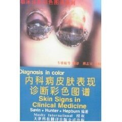 【正版书籍】内科病皮肤表现诊断彩色图谱塞文塞文著车雅敏译天津科技翻译出版公司出版社