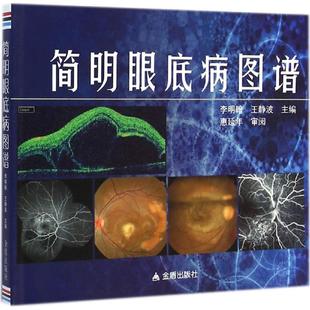 正版新书 简明眼底病图谱 李明翰 金盾出版社