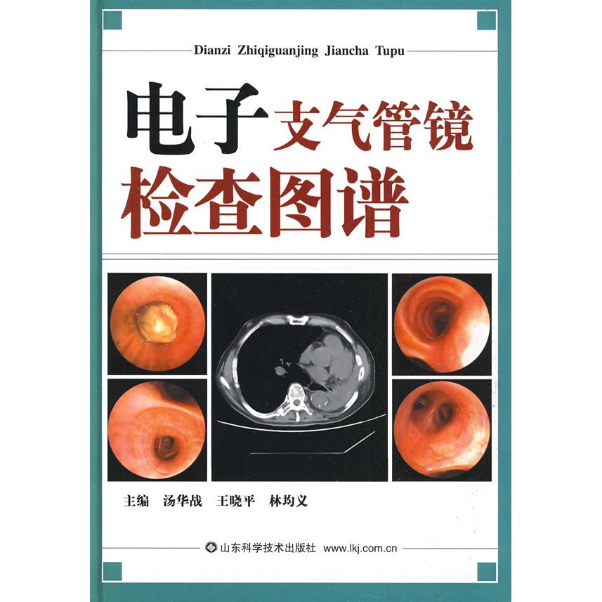 正版新书 电子支气管镜检查图谱 汤华战 王晓平 林均义 山东科学技术出版社