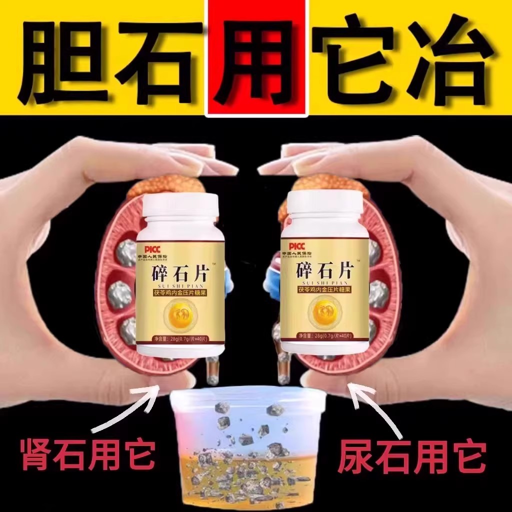 雞內金排石石溶石去膽囊尿石