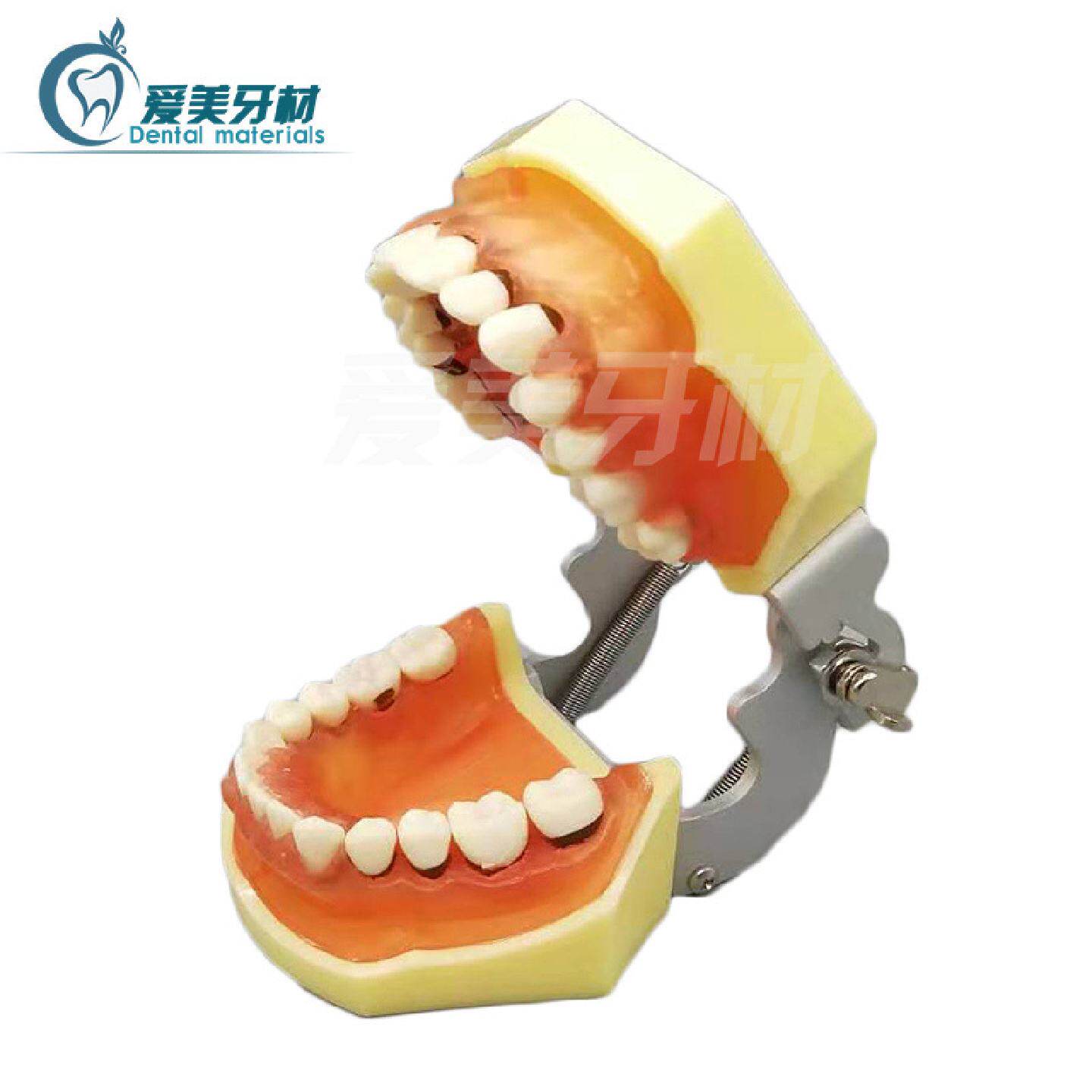牙科牙周实习模型练习龈上下刮治模型牙结石展示牙龈牙周模型