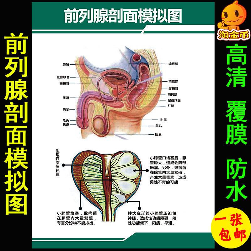 医院前列腺剖面模拟图人体器官结构图 男性生殖器官解剖图海报