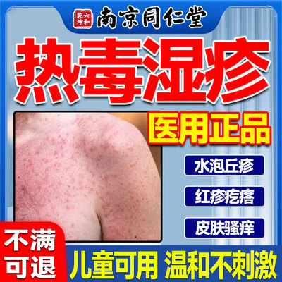 热毒湿疹止痒膏专用除湿血热皮肤水泡去顽固皮炎根真菌感染苗草癣