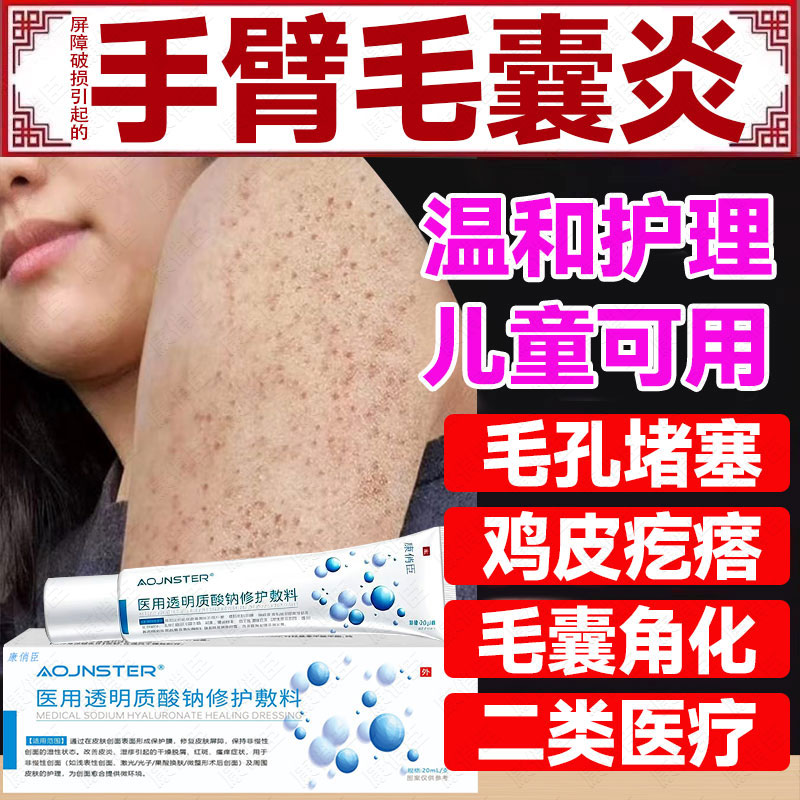 手臂毛囊胳膊上长疙瘩鸡皮肤角化症专角质炎用脂肪小颗粒药监备案