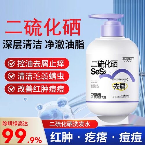 二硫化硒去屑洗发水液溢止痒脂性皮炎毛曩控油止露痒官方旗舰店JS