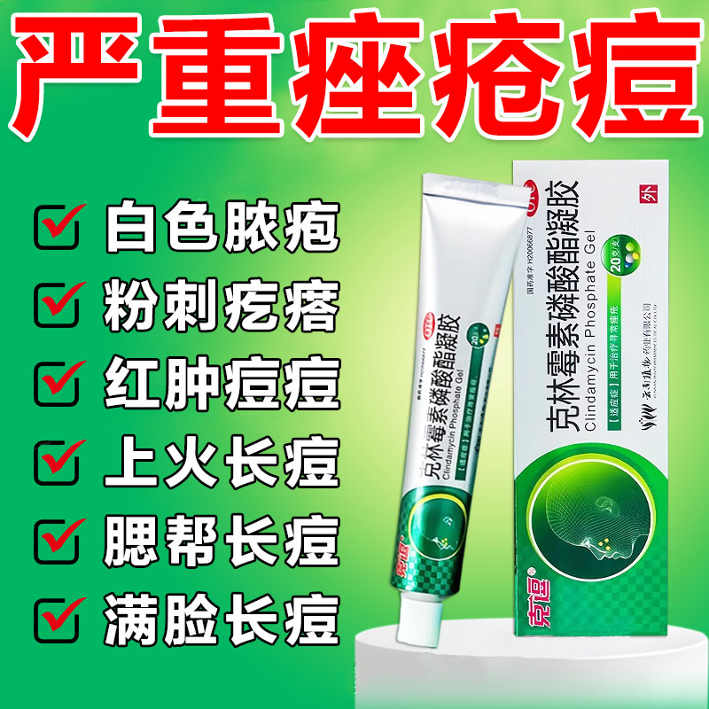 痤疮粉刺祛痘药膏脸上反复长痘痘青春痘熬夜痘克林霉素磷酸酯凝胶