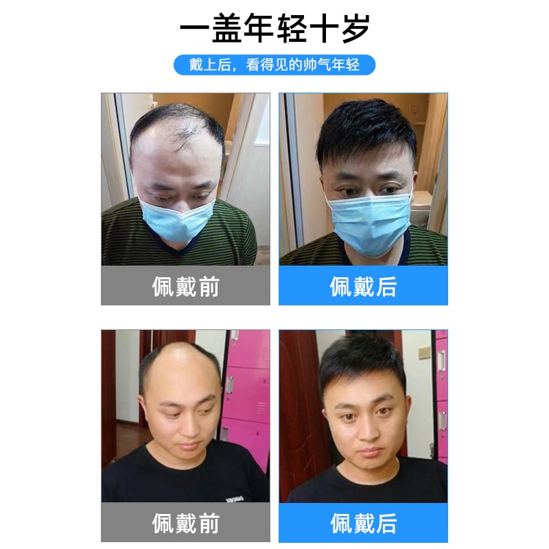 假发男士短发夏季头顶补发片毛寸自然韩版寸头全真人发丝前额刘海