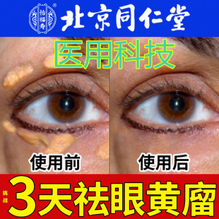 眼睑黄色瘤去眼角皮黄斑膏黄疣脸眼部除脂肪粒祛非专用特效膏神器
