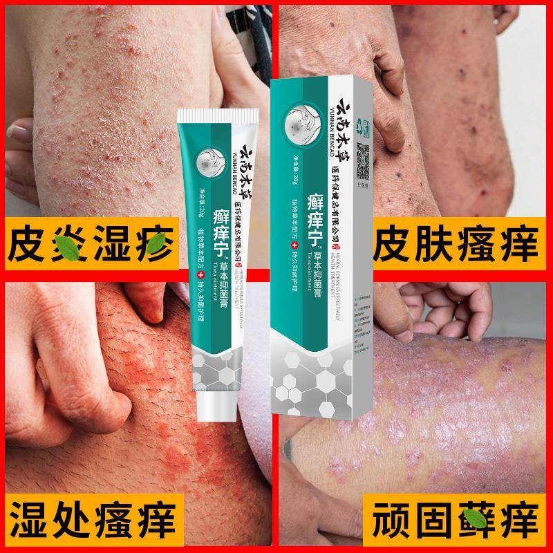 季德胜癣克蛇蜕凝胶抑菌软膏止痒外用皮肤草本乳膏手足起泡止痒膏