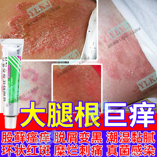 【嘉效】盐酸特比萘芬乳膏10g/(1%)*1支/盒