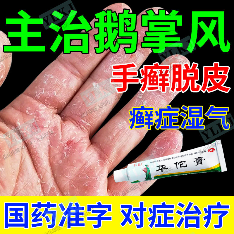 鹅掌风专用手癣药膏杀菌止痒治癣症湿气手部干燥脱皮瘙痒国药正品