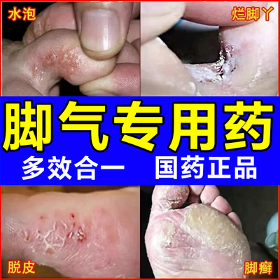 【太极】盐酸特比萘芬凝胶1%*20g*1支/盒