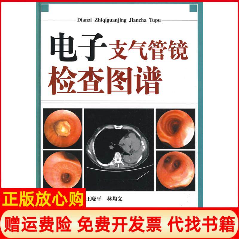 【正版书9成新】电子支气管镜检查图谱汤华战著林均义著王晓平著山东科学技术出版社9787533152062