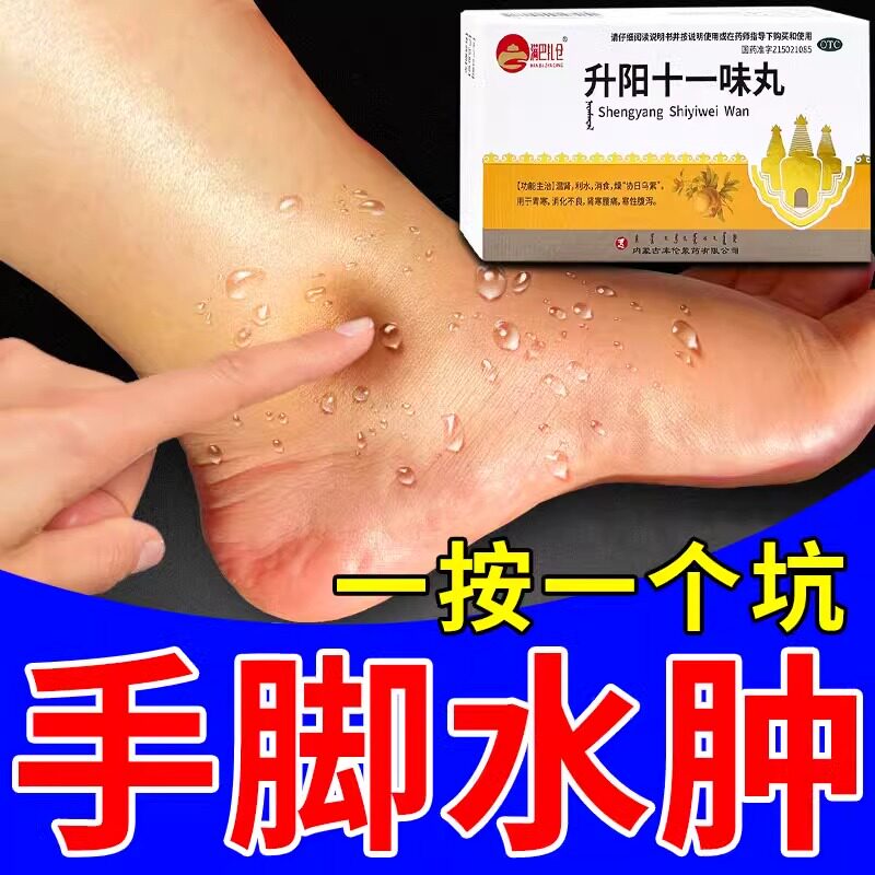 升阳十一味丸利尿消水肿利尿药成人消肿药下肢浮肿水肿消肿专用药