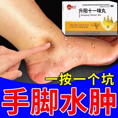 升阳十一味丸利尿消水肿利尿药成人消肿药下肢浮肿水肿消肿专用药