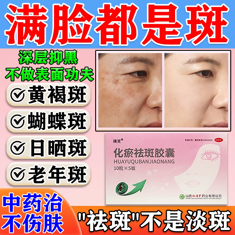 [祺笑]化瘀祛斑胶囊0.32g*50粒/盒