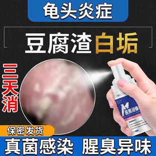 龟头炎症男性真菌感染包皮炎裂口冠状沟珍珠丘疹白垢阴囊瘙痒喷剂