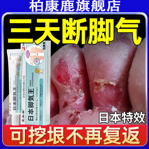 脚气臭脚痒汗脚喷雾止脱皮抑真菌