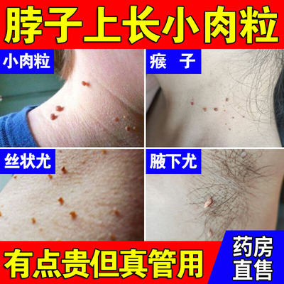 点痣点疣不留痕！精准修护还原肌