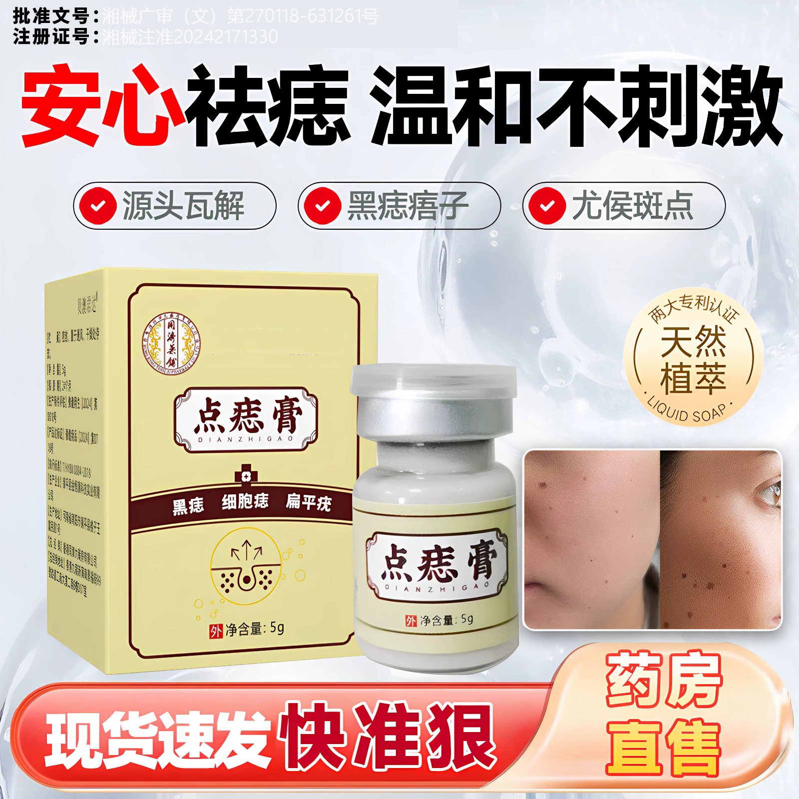 点斑去痣点痣膏脸部专用膏