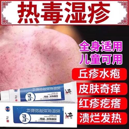 医用热毒湿疹止痒膏皮肤瘙痒