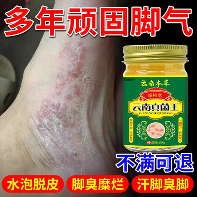 以出5000+云南真菌王脚气膏