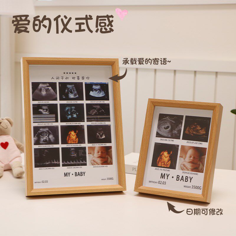 宝宝四维照片彩超相框摆台NT孕期B超打印照片婴儿出生纪念照礼物