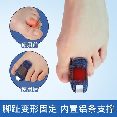 脚趾弯曲矫正套脚趾扭伤脱臼支撑带脚趾变形固定器爪状趾纠正神器