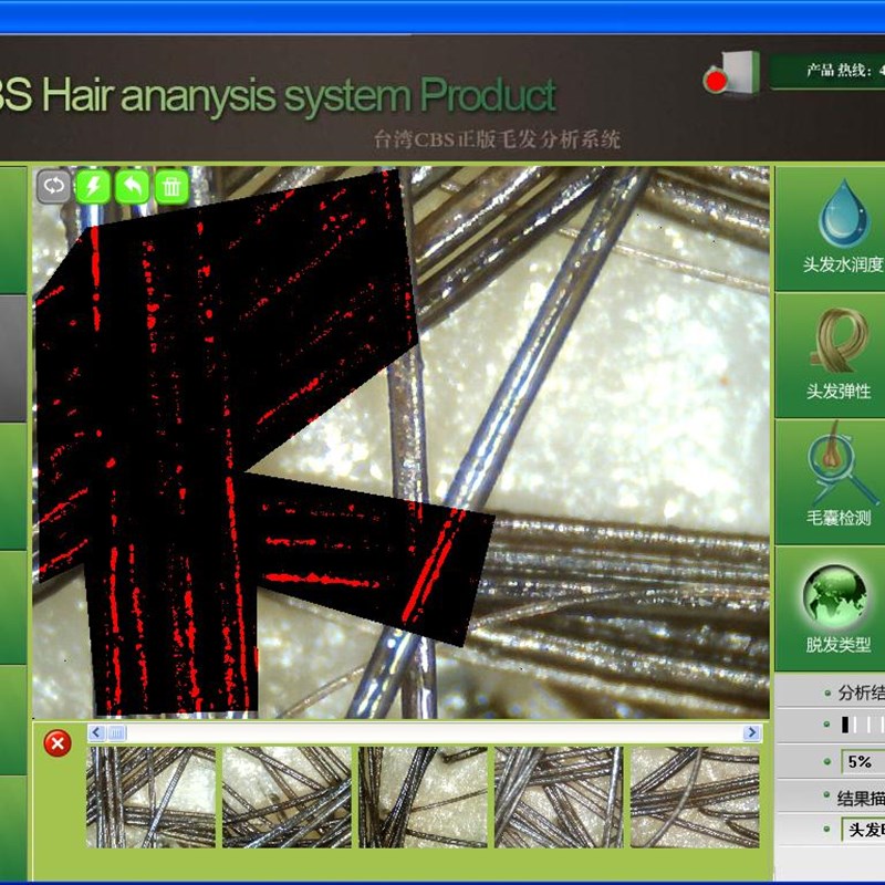 200倍毛发镜头 毛囊镜头 头皮镜头 发质镜头 自动分析镜头