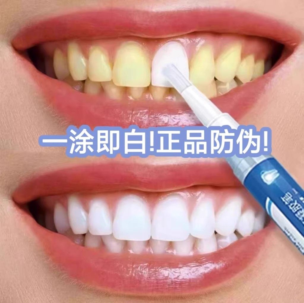 速效牙齿清洁神器炫白洁牙笔去黄烟茶渍增白牙贴专克大黄牙咖喱笔