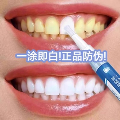 速效牙齿清洁神器炫白洁牙笔去黄烟茶渍增白牙贴专克大黄牙咖喱笔
