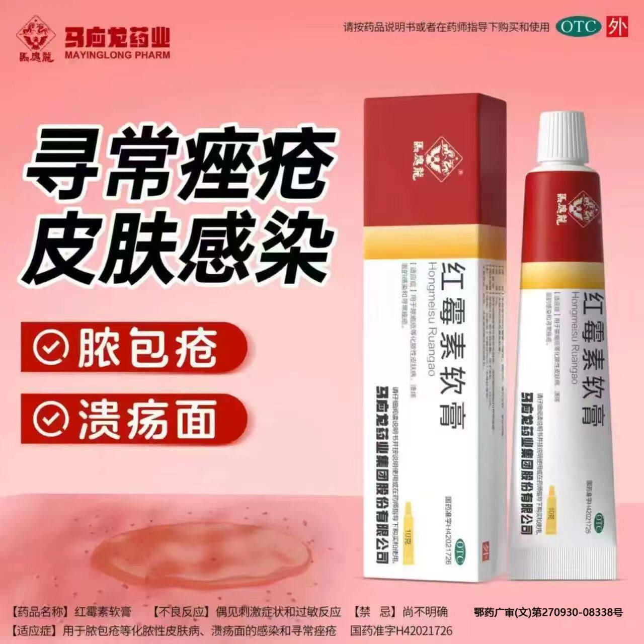 化脓性皮肤病脓疱疮 寻常痤疮溃疡感染止痒 马应龙红霉素软膏10g