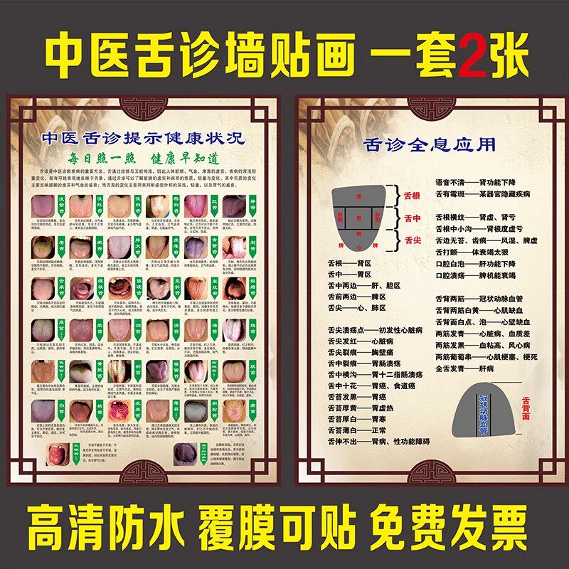 舌诊健康状况对照表图解医院挂图中医经络养生馆舌苔问题海报墙贴