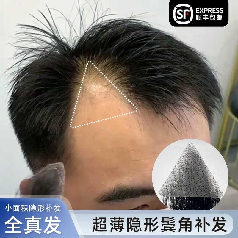 男士鬓角刘海隐形超薄逼真男女鬓角补F发全真发前额发际线假发贴