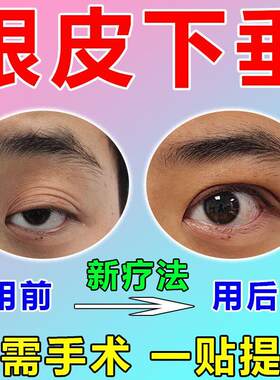 眼皮下垂提拉眼膜双眼皮神器上眼睑防松弛紧致大小眼矫正器专用贴