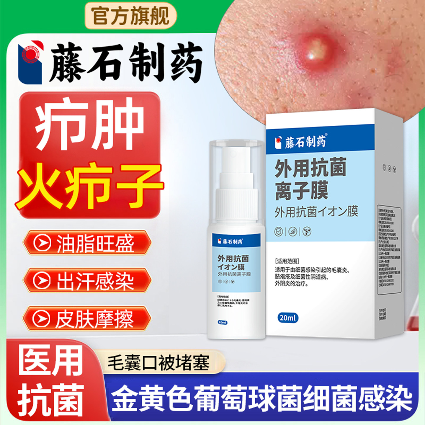 藤石制药抗菌离子膜搭火疖子拔毒拔脓膏脓包硬块疖肿细菌毛囊炎LQ